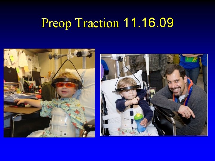 Preop Traction 11. 16. 09 