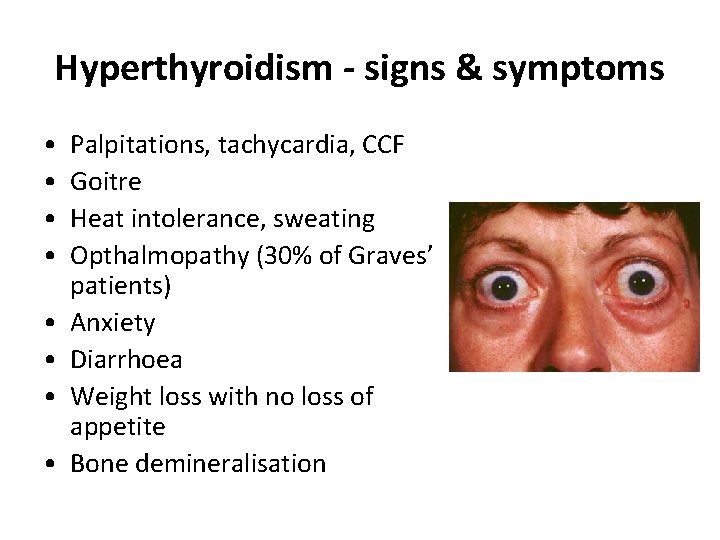 Hyperthyroidism - signs & symptoms • • Palpitations, tachycardia, CCF Goitre Heat intolerance, sweating