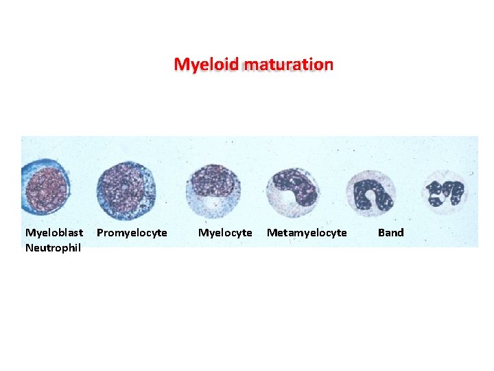Myeloid maturation Myeloblast Neutrophil Promyelocyte Metamyelocyte Band Myeloid maturation Myeloblast Neutrophil Promyelocyte Metamyelocyte Band
