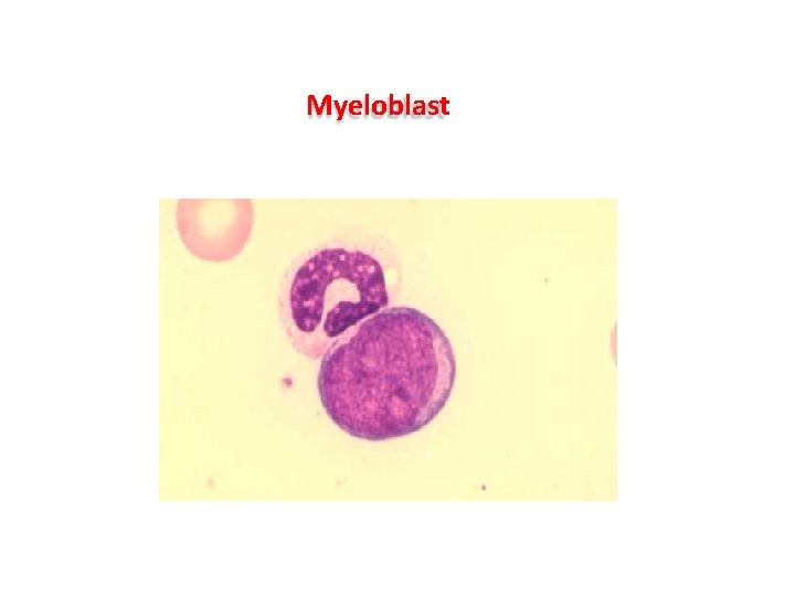 Myeloblast Myeloblast