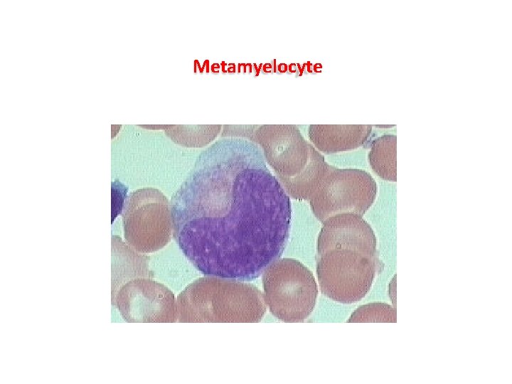 Metamyelocyte Metamyelocyte