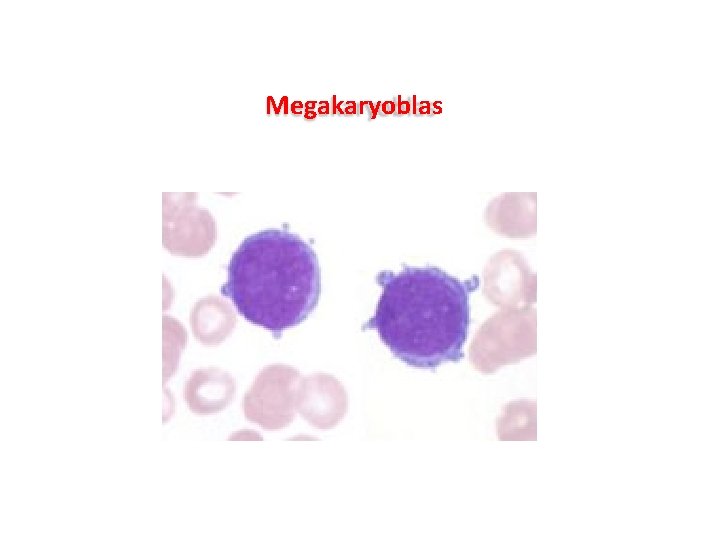 Megakaryoblas Megakaryoblas