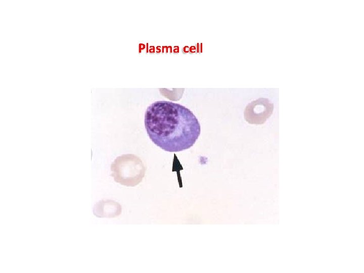 Plasma cell Plasma cell