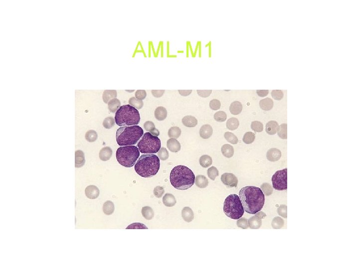 AML-M 1 AML-M 1