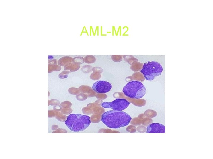 AML-M 2 AML-M 2