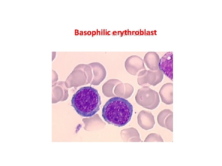 Basophilic erythroblast Basophilic erythroblast