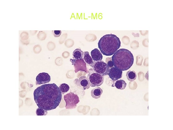 AML-M 6 AML-M 6