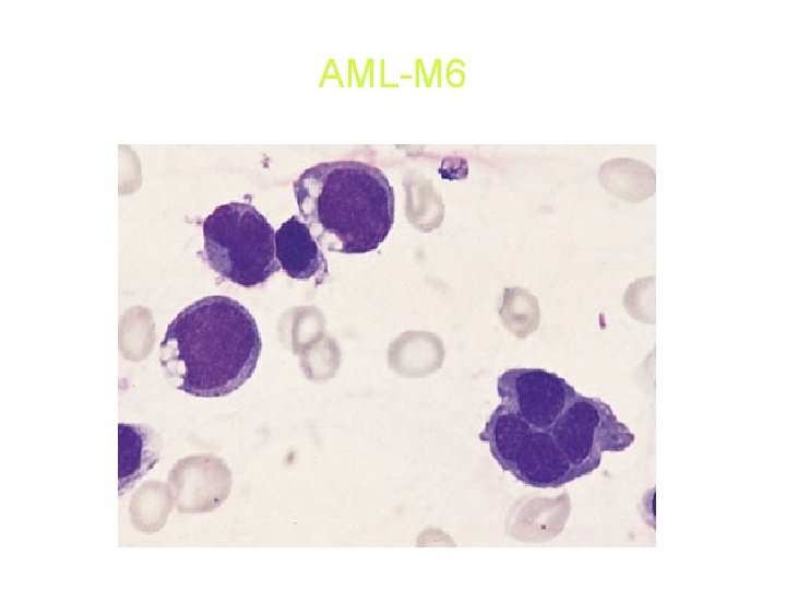 AML-M 6 AML-M 6