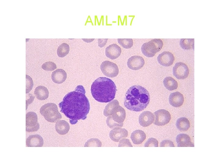 AML-M 7 AML-M 7