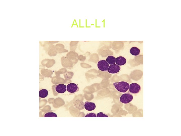 ALL-L 1 ALL-L 1