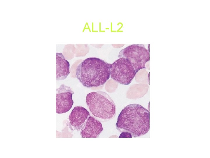 ALL-L 2 ALL-L 2