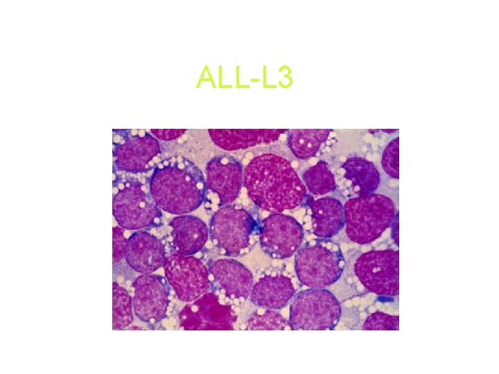 ALL-L 3 ALL-L 3