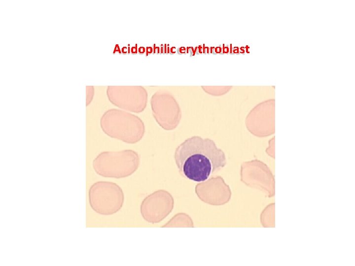 Acidophilic erythroblast Acidophilic erythroblast