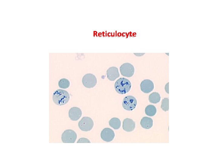 Reticulocyte Reticulocyte