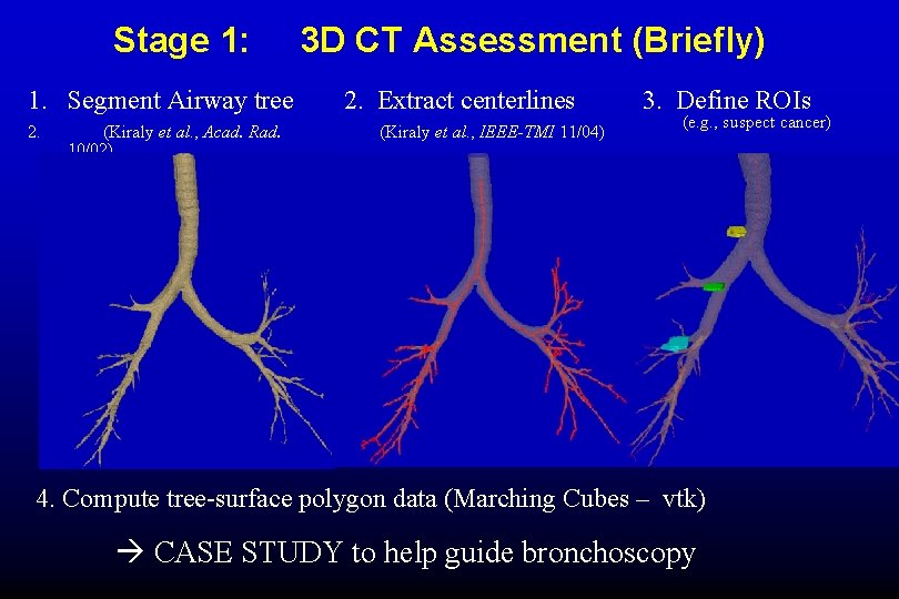 Stage 1: 1. Segment Airway tree 2. (Kiraly et al. , Acad. Rad. 10/02)