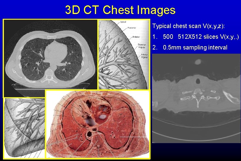 3 D CT Chest Images Typical chest scan V(x, y, z): 1. 500 512