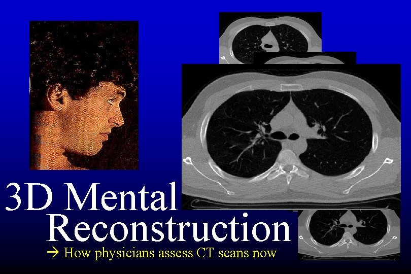 3 D Mental Reconstruction How physicians assess CT scans now 