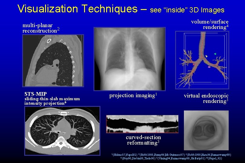Visualization Techniques – see “inside” 3 D Images volume/surface rendering 4 multi-planar reconstruction 2