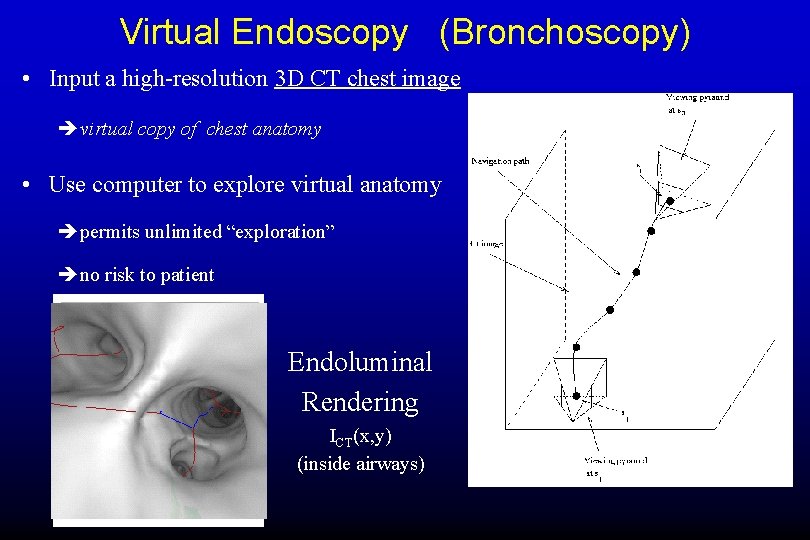 Virtual Endoscopy (Bronchoscopy) • Input a high-resolution 3 D CT chest image è virtual