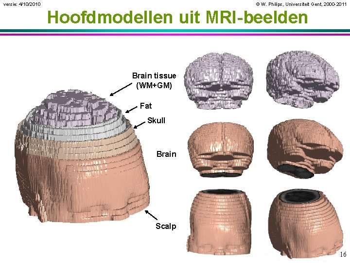 versie: 4/10/2010 © W. Philips, Universiteit Gent, 2000 -2011 Hoofdmodellen uit MRI-beelden Brain tissue
