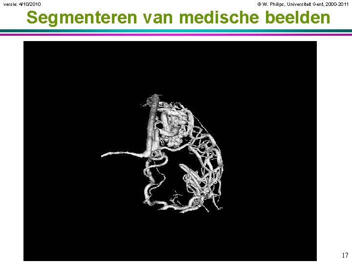 versie: 4/10/2010 © W. Philips, Universiteit Gent, 2000 -2011 Segmenteren van medische beelden 17