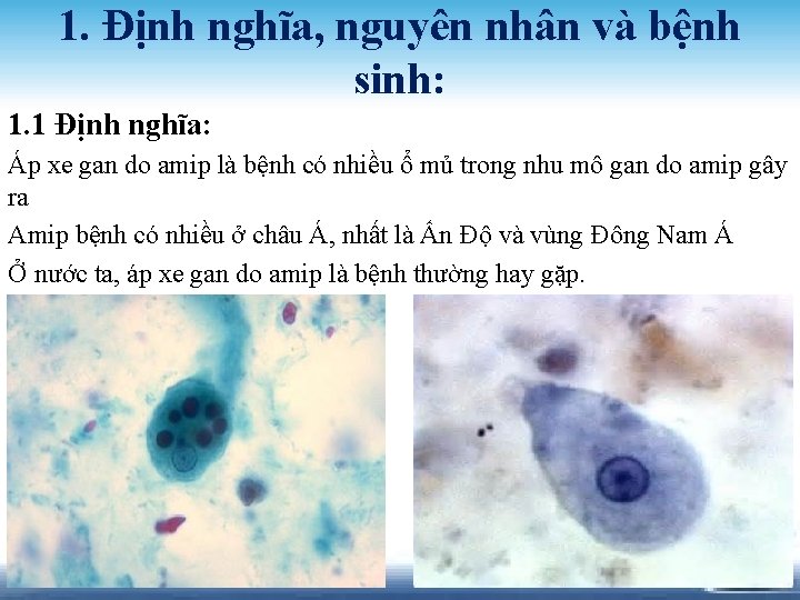 1. Định nghĩa, nguyên nhân và bệnh sinh: 1. 1 Định nghĩa: Áp xe