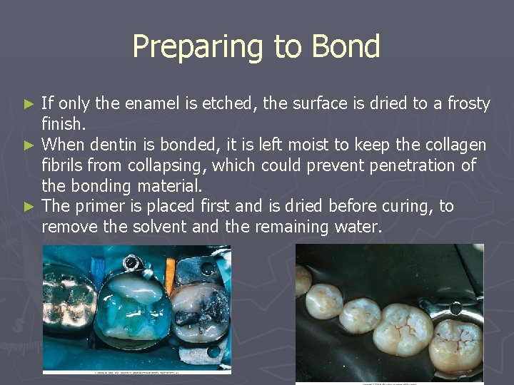 Preparing to Bond If only the enamel is etched, the surface is dried to