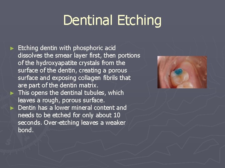 Principles of Bonding Chapter 5 DEN 256 Dental