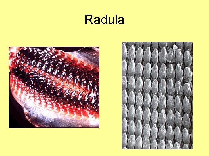Radula Radula