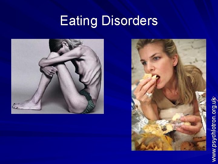 www. psychlotron. org. uk Eating Disorders 