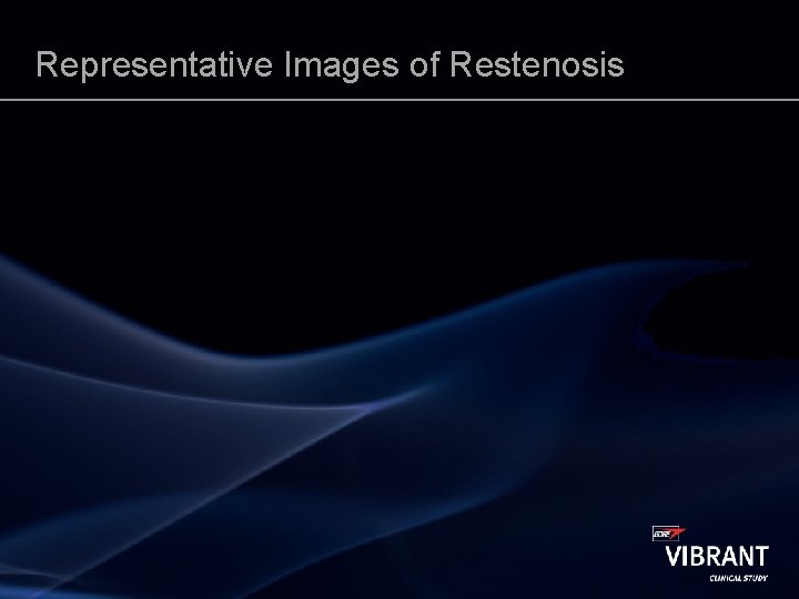 Representative Images of Restenosis 