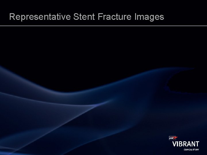 Representative Stent Fracture Images 