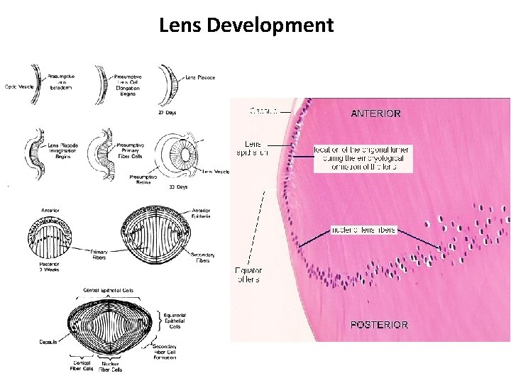 Lens Development 