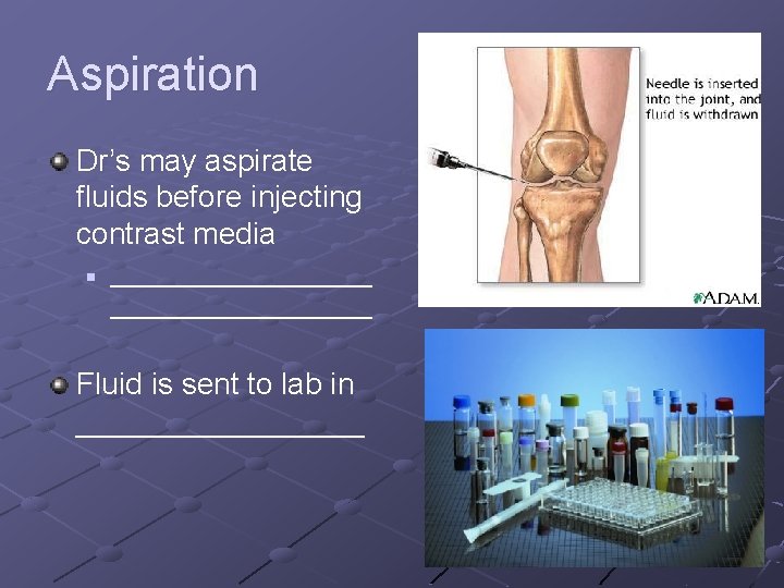 Aspiration Dr’s may aspirate fluids before injecting contrast media n __________________ Fluid is sent