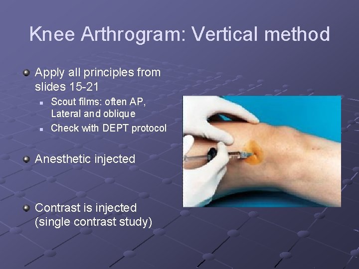 Knee Arthrogram: Vertical method Apply all principles from slides 15 -21 n n Scout