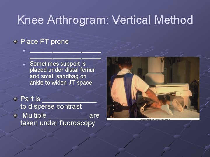 Knee Arthrogram: Vertical Method Place PT prone n n ______________________ Sometimes support is placed