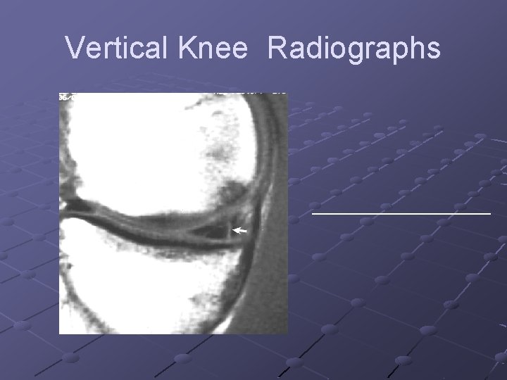 Vertical Knee Radiographs __________ 