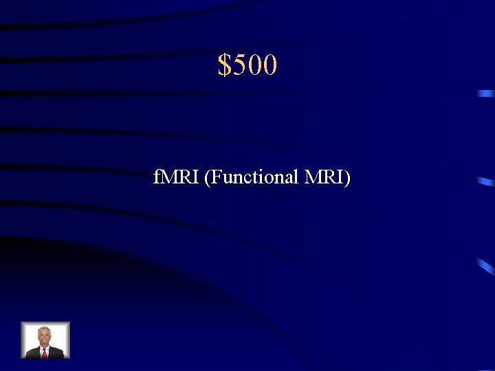 $500 f. MRI (Functional MRI) 