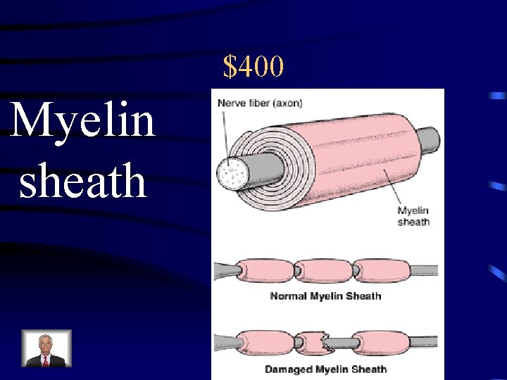 $400 Myelin sheath 