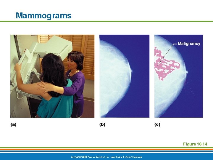 Mammograms Figure 16. 14 Copyright © 2009 Pearson Education, Inc. , publishing as Benjamin