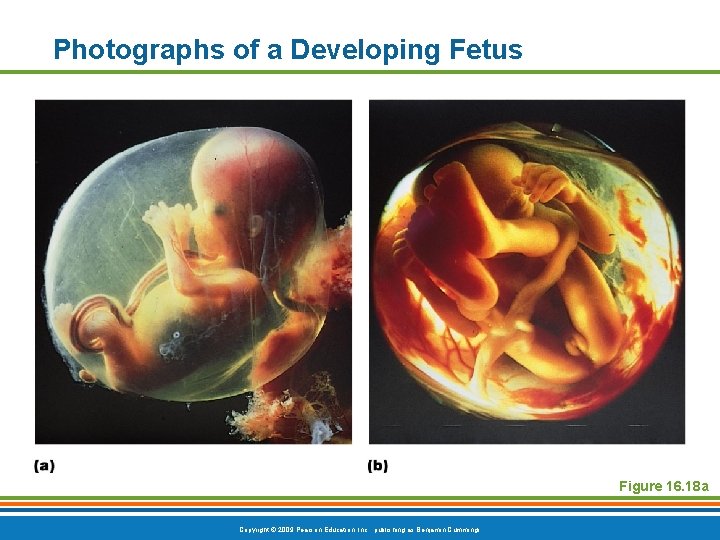 Photographs of a Developing Fetus Figure 16. 18 a Copyright © 2009 Pearson Education,