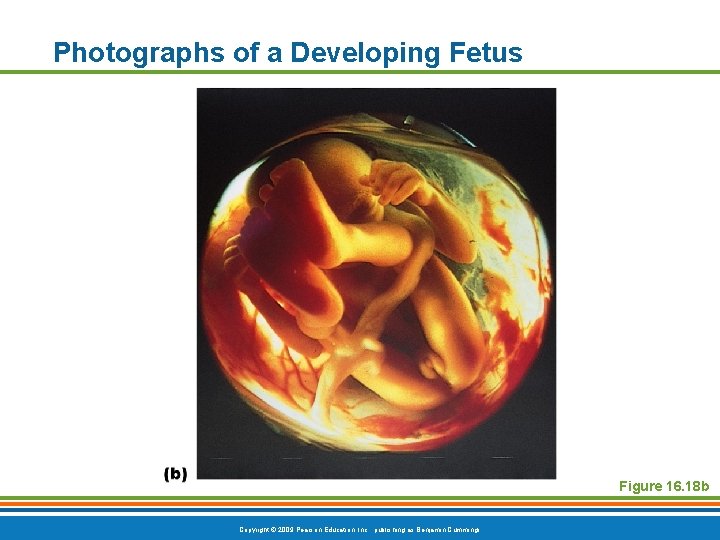 Photographs of a Developing Fetus Figure 16. 18 b Copyright © 2009 Pearson Education,