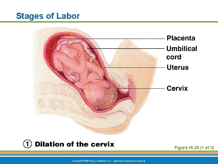 Stages of Labor Figure 16. 20 (1 of 3) Copyright © 2009 Pearson Education,