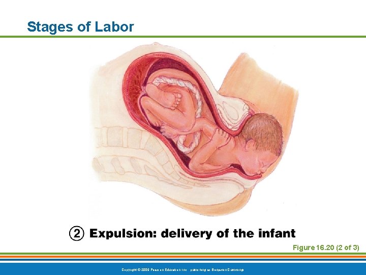 Stages of Labor Figure 16. 20 (2 of 3) Copyright © 2009 Pearson Education,