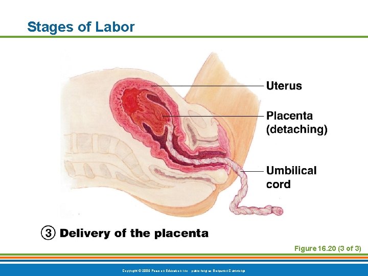 Stages of Labor Figure 16. 20 (3 of 3) Copyright © 2009 Pearson Education,