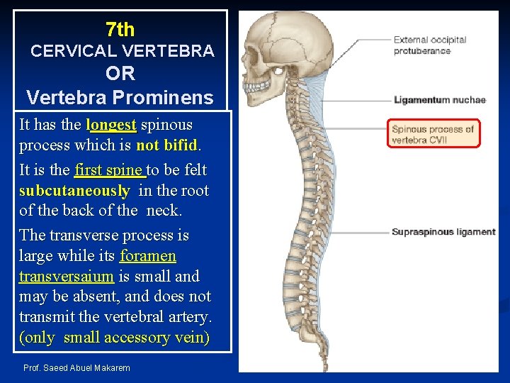 7 th CERVICAL VERTEBRA OR Vertebra Prominens It has the longest spinous process which