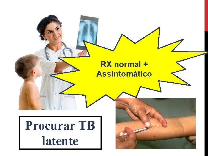 RX normal + Assintomático Procurar TB latente 
