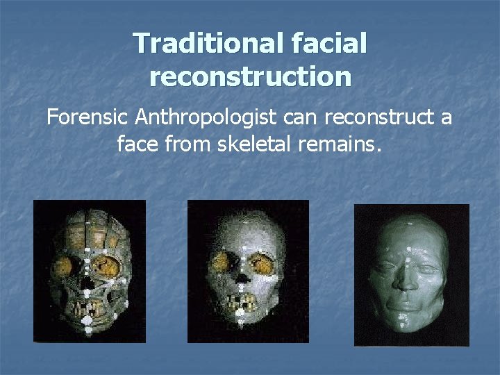 Traditional facial reconstruction Forensic Anthropologist can reconstruct a face from skeletal remains. Traditional facial reconstruction Forensic Anthropologist can reconstruct a face from skeletal remains.