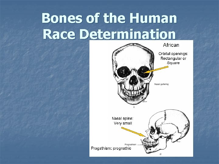 Bones of the Human Race Determination Bones of the Human Race Determination