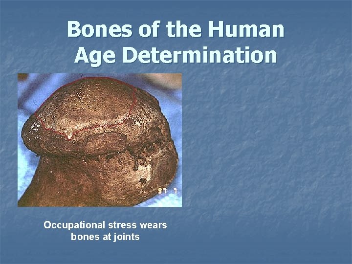 Bones of the Human Age Determination Occupational stress wears bones at joints Bones of the Human Age Determination Occupational stress wears bones at joints